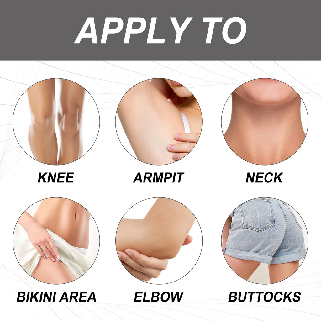 Whitening Cream Private Parts Underarm Bleaching Butt Knee Brighten Inner Thigh Intimate Parts Dark Remove Melanin Fine Skin