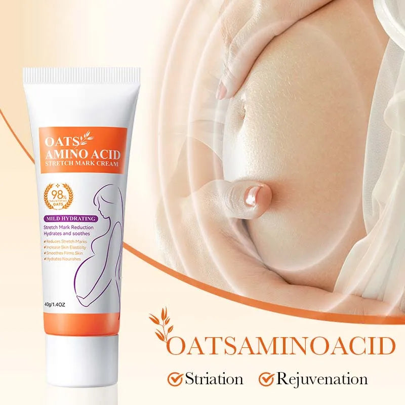 Stretch Marks Removal Cream Eliminate Body Belly Stretch Marks Swelling ade Stretch Marks Repair Firming Care
