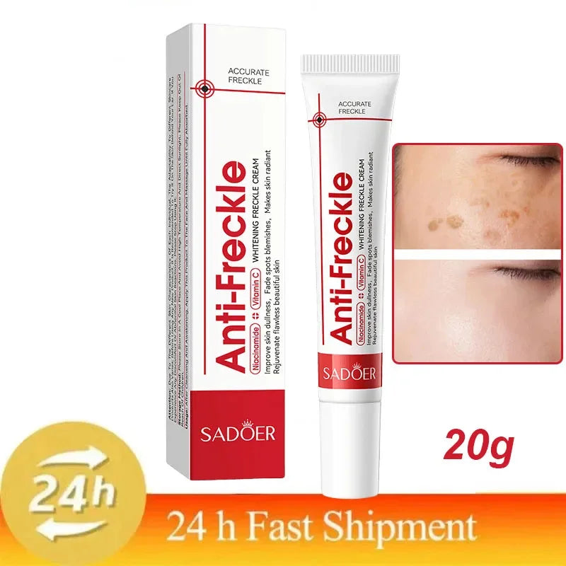 Whitening Freckle Cream Remove Dark Spots Anti Freckle Face Creams Niacinamide Fade Pigmentation Melasma Brighten Skin Care 20g