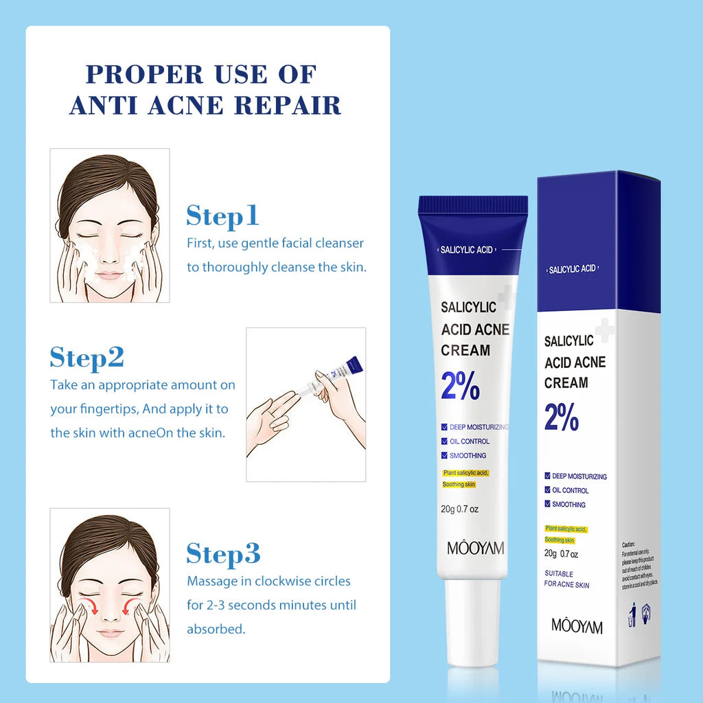 Salicylic Acid Acne Treatment Cream, Gentle Moisturizing Cream