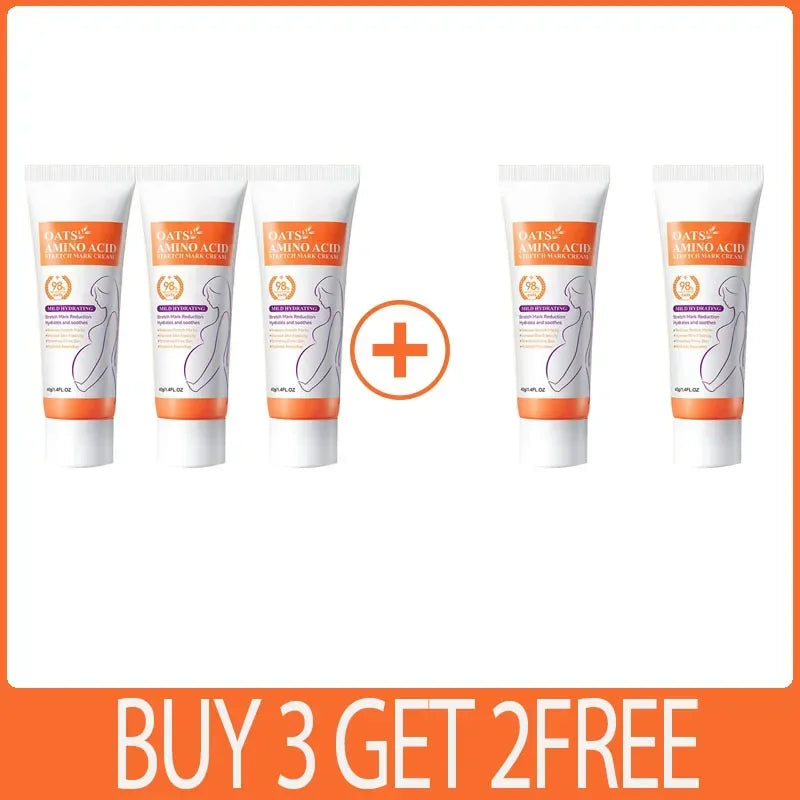 Stretch Marks Removal Cream Eliminate Body Belly Stretch Marks Swelling ade Stretch Marks Repair Firming Care