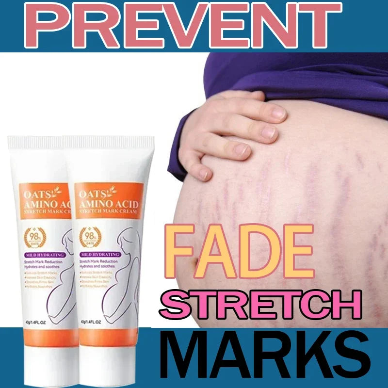 Stretch Marks Permanent Removal Cream Eliminate Body Belly Stretch Marks Swelling Marks Remove Skin Cracks Repair Firming Care