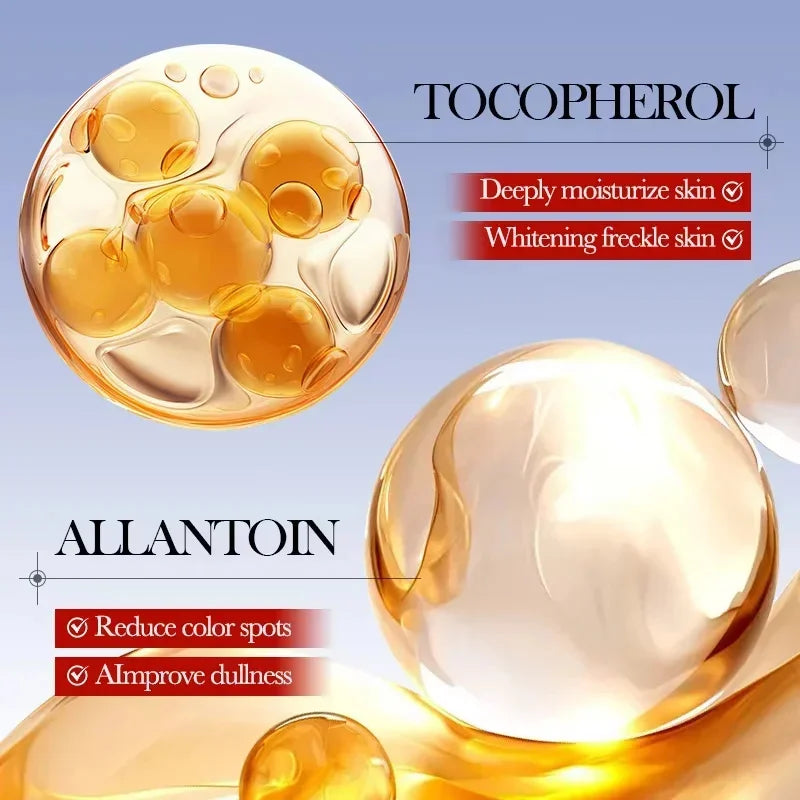 Whitening Freckle Cream Remove Dark Spots Anti Freckle Face Creams Niacinamide Fade Pigmentation Melasma Brighten Skin Care 20g