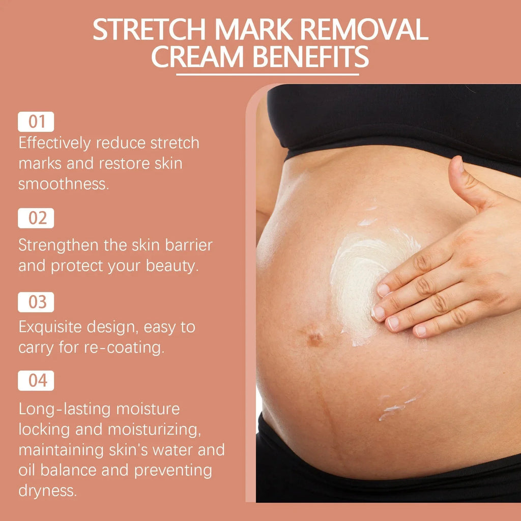 Pregnancy Repair Stretch Mark Removal Acne Scar Maternity Stretch Marks Remove Fat Striae Scars Treatment skin Care