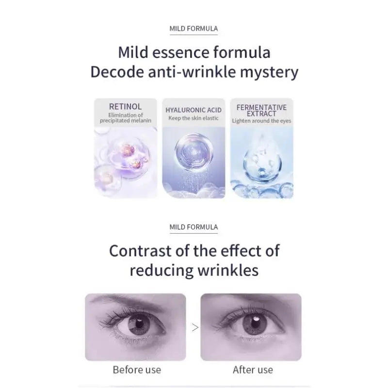 Hyaluronic Acid Eye Cream Roller For Wrinkles Dark Circles Puffiness Anti Aging Treatment Moisturizer Skin Care