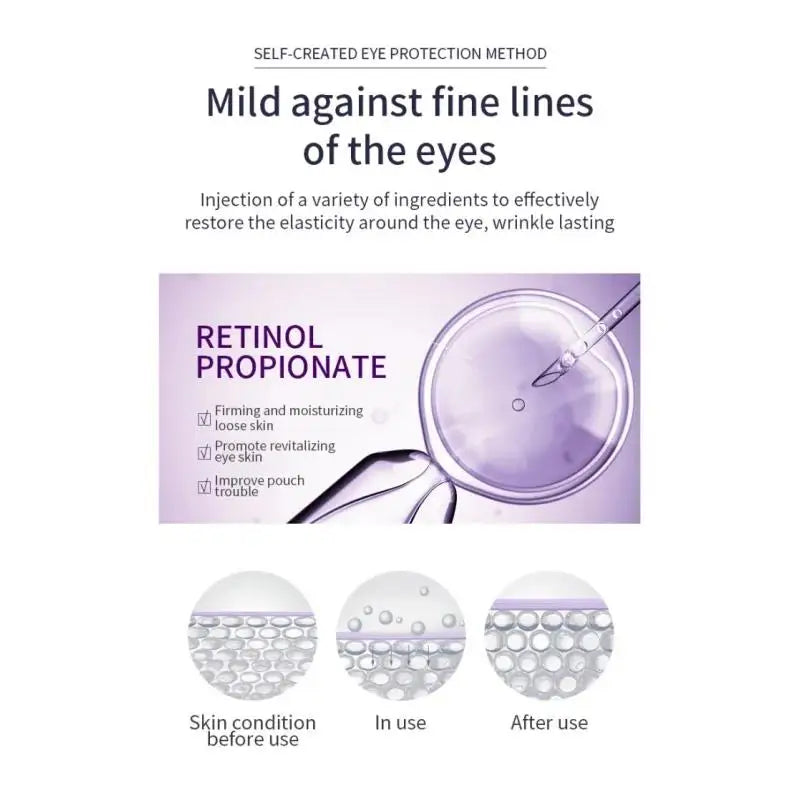 Hyaluronic Acid Eye Cream Roller For Wrinkles Dark Circles Puffiness Anti Aging Treatment Moisturizer Skin Care