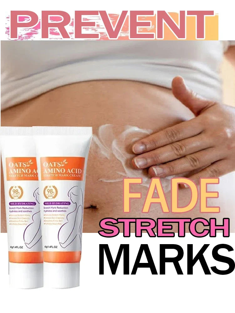 Stretch Marks Removal Cream Eliminate Body Belly Stretch Marks Swelling ade Stretch Marks Repair Firming Care