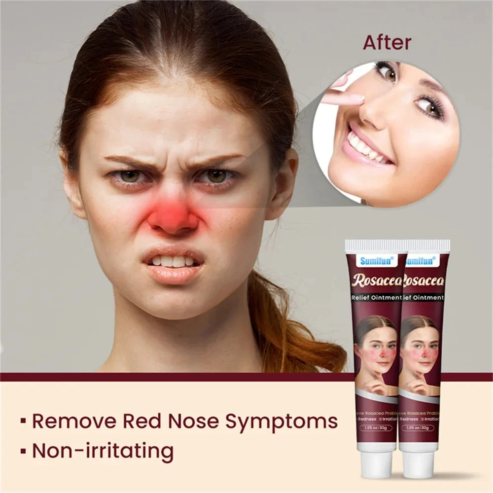 Repair Facial Redness Cream Instant Spider Vein Remove Sensitive Skin Sooth Anti Redness Rosacea Treat Lotion Korean Cosmetics