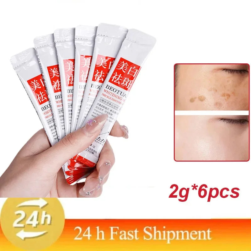 Whitening Freckle Cream Remove Dark Spots Anti Freckle Face Creams Niacinamide Fade Pigmentation Melasma Brighten Skin Care 20g