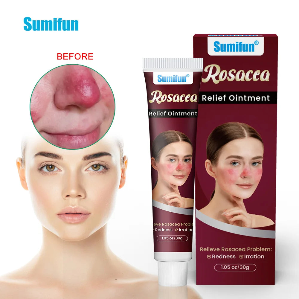 Repair Facial Redness Cream Instant Spider Vein Remove Sensitive Skin Sooth Anti Redness Rosacea Treat Lotion Korean Cosmetics