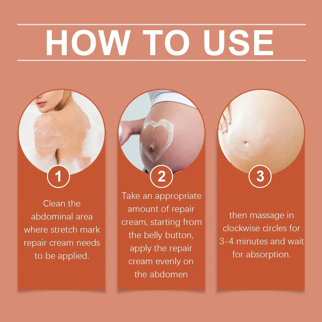 Pregnancy Repair Stretch Mark Removal Acne Scar Maternity Stretch Marks Remove Fat Striae Scars Treatment skin Care