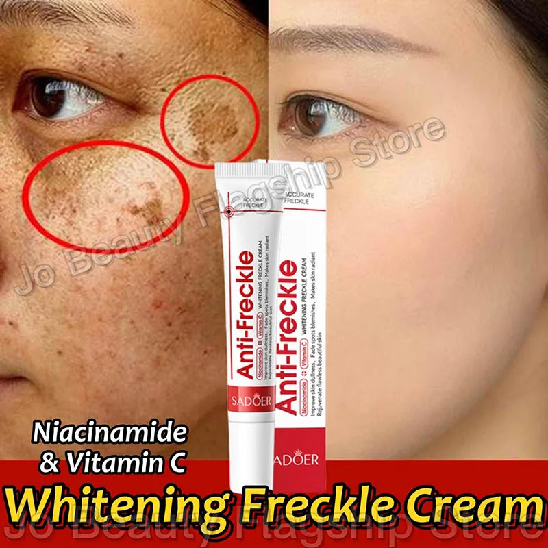 Whitening Freckle Cream Remove Dark Spots Anti Freckle Face Creams Niacinamide Fade Pigmentation Melasma Brighten Skin Care 20g