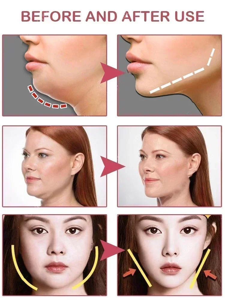 NewFirming Face-lift Slimming Cream V-Shape Slimming Removal Masseter Muscle Double Chin Face Fat Burning Anti-aging Products 3