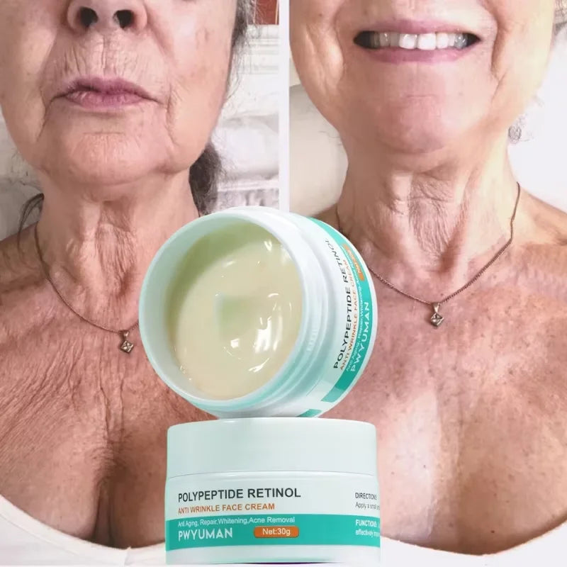 Retinol Wrinkle Remover Face Cream Firming Lifting Anti Aging Fade Fine Lines Moisturizing Whitening Repair Skin Care Cosmetics